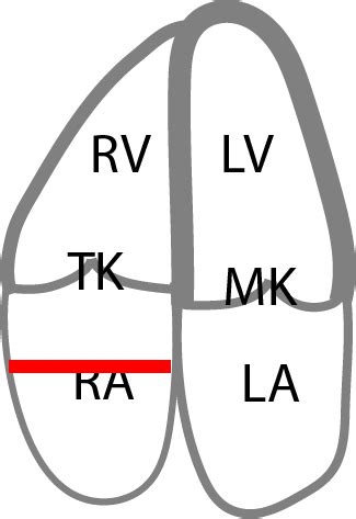 echocardia normal size.